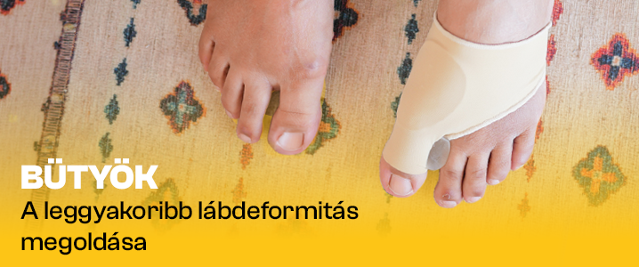 A bütyök – és amit tehetünk ellene